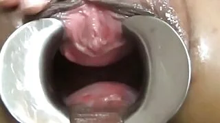 アジア人用膣鏡